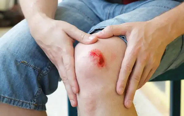 تعبیر خواب زخم حضرت یوسف + برای زن متاهل و باردار و دختر مجرد