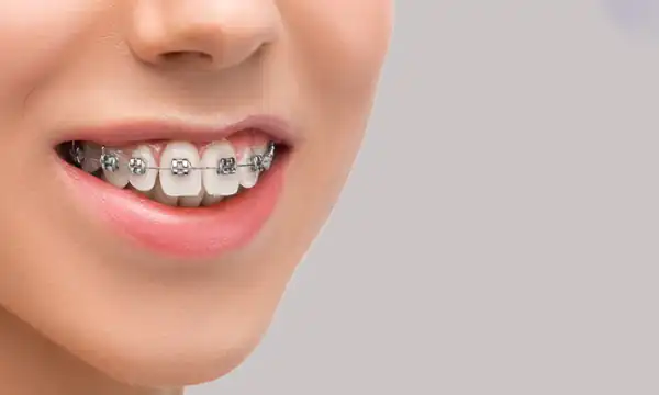 تعبیر خواب دندان جلو زن + برای زن متاهل و باردار و دختر مجرد