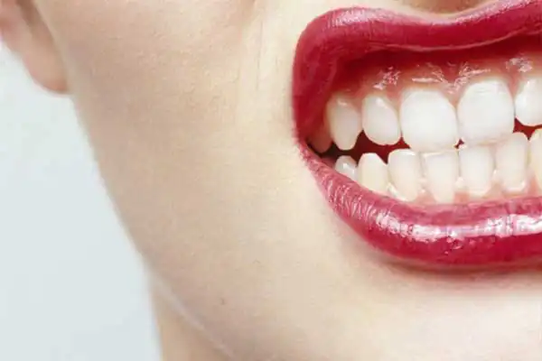 تعبیر خواب روانشناسی دندان + برای زن متاهل و باردار و دختر مجرد