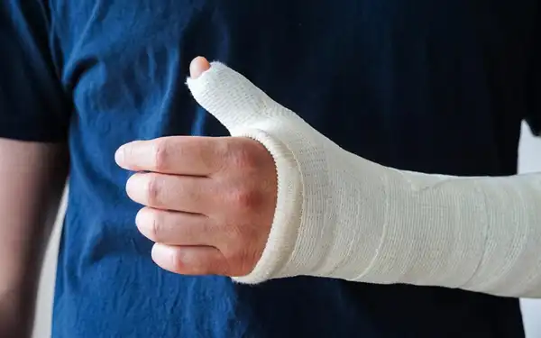تعبیر خواب دست شکسته + برای زن متاهل و باردار و دختر مجرد