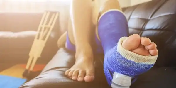 تعبیر خواب پا شکسته + برای زن متاهل و باردار و دختر مجرد