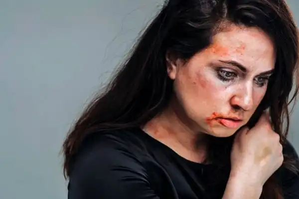 تعبیر خواب صورت زخمی زن + برای زن متاهل و باردار و دختر مجرد