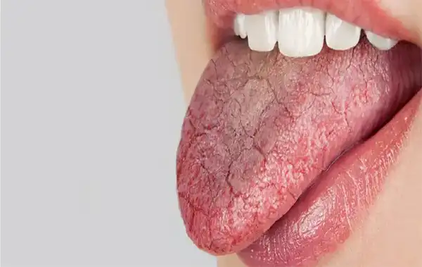 تعبیر خواب دهان مرده + برای زن متاهل و باردار و دختر مجرد