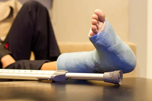 تعبیر خواب تصادف و شکستن پا + برای زن متاهل و باردار و دختر مجرد