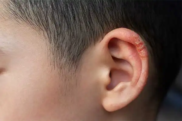 تعبیر خواب زخم شدن گوش + برای زن متاهل و باردار و دختر مجرد