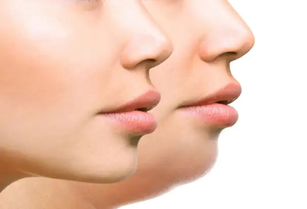 تعبیر خواب لاغری صورت + برای زن متاهل و باردار و دختر مجرد